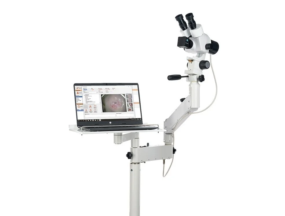 Межрайонная больница № 1 заключила контракт на поставку двух кольпоскопов из перечня закупок 2025 года